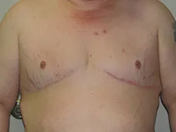 Test Case Image