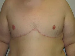 Test Case Image