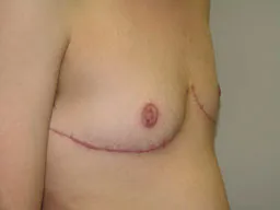 Test Case Image