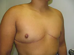 Test Case Image