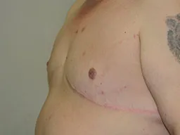 Test Case Image