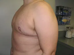 Test Case Image