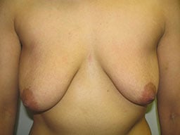 Test Case Image