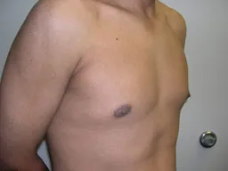 Test Case Image