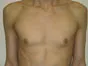 Test Case Image