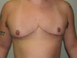 Test Case Image