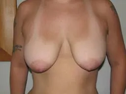 Test Case Image